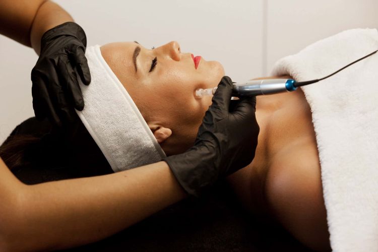 Mikrodermabrasion